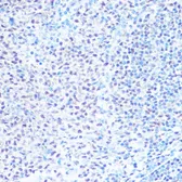 Anti-SNRPB antibody used in IHC (Paraffin sections) (IHC-P). GTX66411