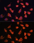 Anti-Prefoldin 5 antibody used in Immunocytochemistry/ Immunofluorescence (ICC/IF). GTX66432