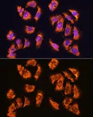 Anti-alpha Sarcoglycan antibody used in Immunocytochemistry/ Immunofluorescence (ICC/IF). GTX66435
