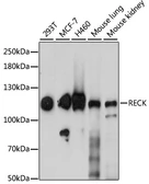 Anti-RECK antibody used in Western Blot (WB). GTX66481