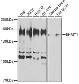 Anti-GLP antibody used in Western Blot (WB). GTX66528