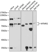 Anti-MTMR2 antibody used in Western Blot (WB). GTX66550