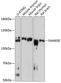 Anti-FAM65B antibody used in Western Blot (WB). GTX66562