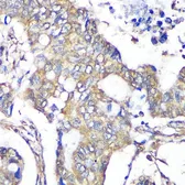Anti-TXNDC9 antibody used in IHC (Paraffin sections) (IHC-P). GTX66578