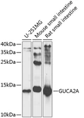 Anti-Guanylin antibody used in Western Blot (WB). GTX66582