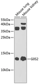 Anti-G0/G1switch 2 antibody used in Western Blot (WB). GTX66594