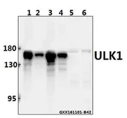 Anti-ULK1 antibody used in Western Blot (WB). GTX66613