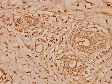 Anti-Cystatin B antibody used in IHC (Paraffin sections) (IHC-P). GTX66627