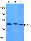 Anti-JAK3 antibody used in Western Blot (WB). GTX66640