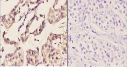 Anti-PERK antibody used in IHC (Paraffin sections) (IHC-P). GTX66661