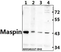 Anti-MASPIN antibody used in Western Blot (WB). GTX66666