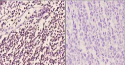Anti-PU.1 antibody used in IHC (Paraffin sections) (IHC-P). GTX66691