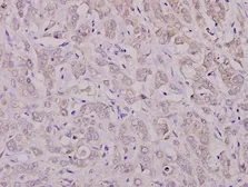Anti-PKC zeta (phospho Thr410) antibody used in IHC (Paraffin sections) (IHC-P). GTX66730