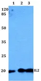 Anti-IL2 antibody used in Western Blot (WB). GTX66758