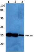 Anti-HOXB7 antibody used in Western Blot (WB). GTX66766