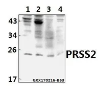Anti-PRSS2 antibody used in Western Blot (WB). GTX66818