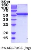 Rat GPT protein, His tag (active). GTX67026-pro