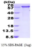 Human PPIL2 protein, His tag (active). GTX67132-pro