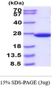 Human SOD2 protein, His tag (active). GTX67156-pro