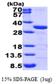 Human CLIC1 protein, His tag. GTX67305-pro
