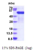 Human EEF1G protein, His tag. GTX67368-pro