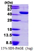 Human GMDS protein, His tag. GTX67416-pro