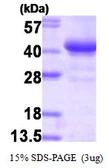 Human Glycogenin 1 protein, His and T7 tag. GTX67448-pro