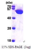 Human HARS protein, His tag. GTX67451-pro