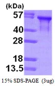 Human Tau381 (1N3R) protein, His tag. GTX67539-pro