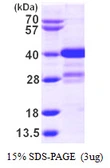 Human MLF1 protein, His tag. GTX67556-pro