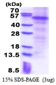 Human Parkin protein, His tag. GTX67612-pro