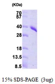 Human PRPS1 protein, His tag. GTX67685-pro