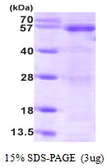 Human PTEN protein, His tag. GTX67706-pro