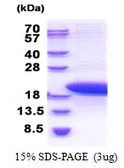 Human PTMS protein, His tag. GTX67709-pro