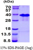 Human RNF4 protein, His tag. GTX67753-pro