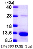 Human S100A5 protein, His tag. GTX67790-pro