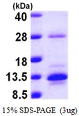 Human S100A10 protein, His tag. GTX67796-pro