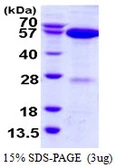 Human APPBP1 protein, His tag. GTX68013-pro