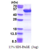 Human GRP1 protein, His tag. GTX68039-pro