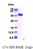 Human GRHPR protein, His tag. GTX68050-pro