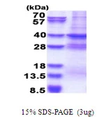 Human MED27 protein, His tag. GTX68056-pro