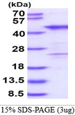 Human Homer3 protein, His tag. GTX68061-pro
