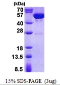 Human Guanine deaminase protein, His tag. GTX68082-pro