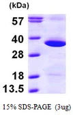 Human GNPDA1 protein, His tag. GTX68101-pro