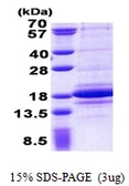 Human C1D protein, His tag. GTX68152-pro