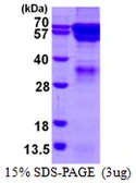 Human RGS14 protein, His tag. GTX68185-pro