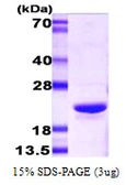 Mouse alpha B Crystallin protein. GTX68257-pro