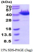 Mouse Ogg1 protein, His tag. GTX68277-pro