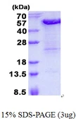 Human KIN protein, His tag. GTX68308-pro