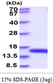 Rat L-FABP protein, His tag. GTX68352-pro